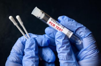 Covid-19 Tedbirleri Kapsamında Ülkelere Giriş Tablosu